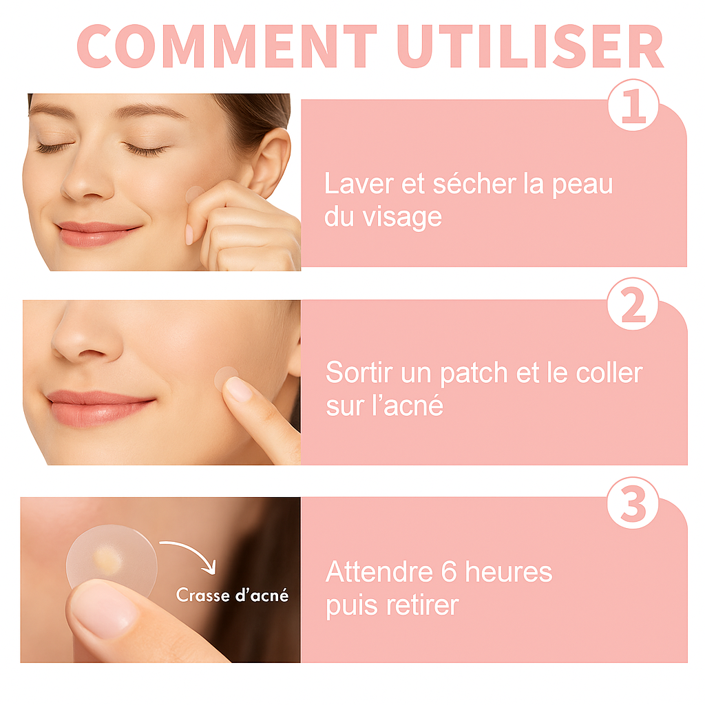 Cerotto Anti Acne